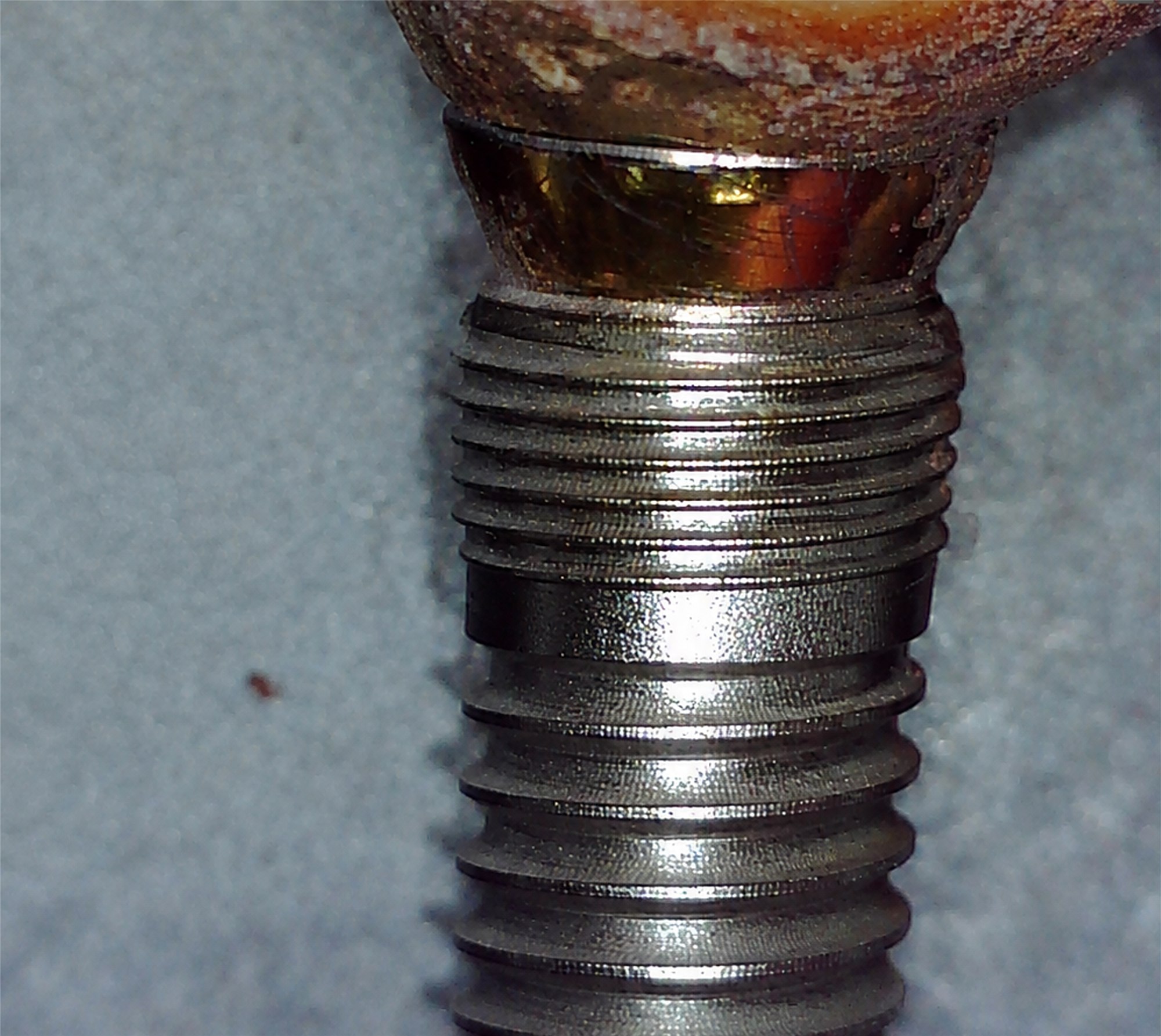 Impianto rimosso A03 dopo il debridement con il NiTi Brush
