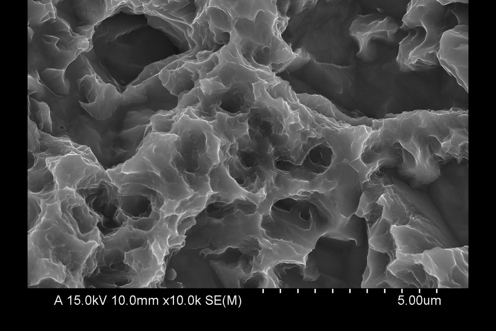 SEM at 10,000x of a contaminated implant surface