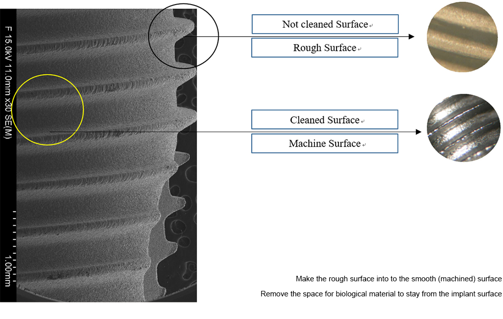 Implant surface returning to a smooth, shiny finish after debridement