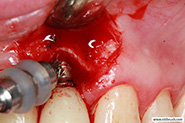 Finishing using a membrane