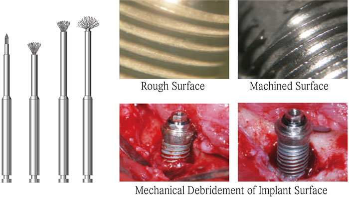 NiTi Brush for peri-implantitis catalogue cover